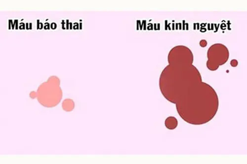 mau-bao-thai-khac-mau-kinh-nguyet-nhu-the-nao Máu báo thai khác máu kinh nguyệt như thế nào?