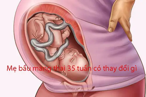 me-bau-mang-thai-35-tuan-co-thay-doi-gi Mẹ bầu mang thai 35 tuần có thay đổi gì