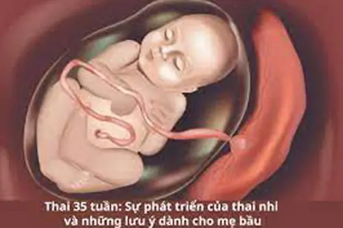 su-phat-trien-cua-thai-nhi-35-tuan-tuoi Sự phát triển của thai nhi 35 tuần tuổi
