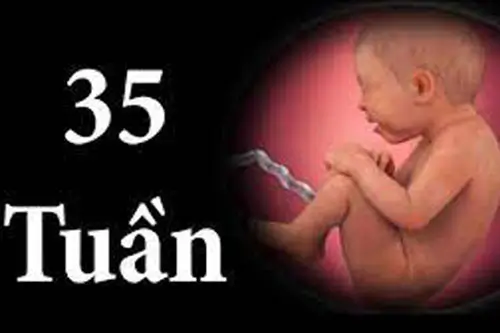 thai-35-tuan-la-may-thang Thai 35 tuần là mấy tháng