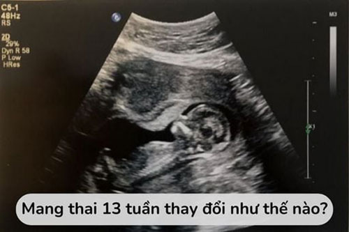 Thai nhi 13 tuần tuổi phát triển như thế nào
